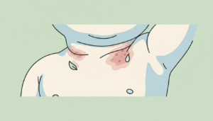 découvrez l'intertrigo chez le bébé, une dermatose courante des plis cutanés, ses causes, symptômes et conseils pour prévenir et traiter cette irritation de la peau délicate des tout-petits.